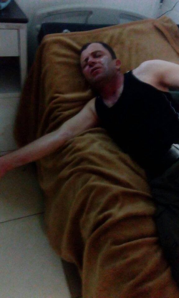 Major Jamal, Peshmerga officer, is hospitalised after ISIS used Mustard agent near Zummar. 